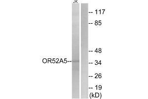 Western blot analysis of extracts from Jurkat cells, using OR52A5 antibody. (OR52A5 antibody  (Internal Region))