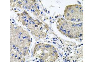 Immunohistochemistry of paraffin-embedded Human stomach using NDUFA6 Polyclonal Antibody at dilution of 1:100 (40x lens). (NDUFA6 antibody)