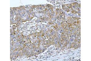 IHC analysis of RPL32 using anti-RPL32 antibody (ABIN7602916).