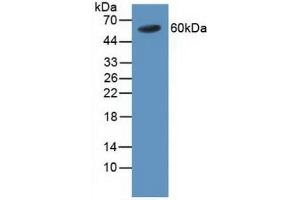 Detection of TRAF4 in Human Blood Cells using Polyclonal Antibody to TNF Receptor Associated Factor 4 (TRAF4) (TRAF4 antibody  (AA 193-444))