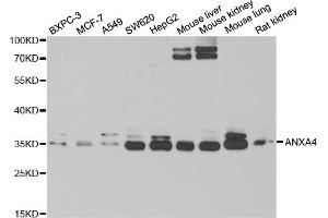 Western blot analysis of extracts of various cell lines, using ANXA4 antibody (ABIN5973706) at 1/1000 dilution. (Annexin IV antibody)