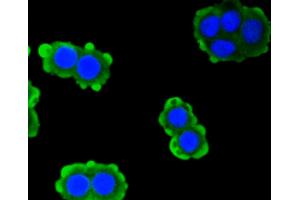 Immunofluorescence analysis of CRC cells using PRKCA antibody (ABIN4904772). (PKC alpha antibody)