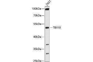 Western blot analysis of extracts of 293T cells, using TBX19 antibody (ABIN6130723, ABIN6148904, ABIN6148905 and ABIN6214752) at 1:1000 dilution. (T-Box 19 antibody  (AA 229-448))