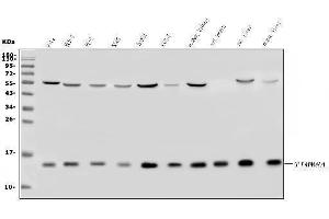 Western blot analysis of TIMM8A/DDP using anti-TIMM8A/DDP antibody (ABIN7600039).