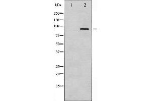 Western blot analysis of PKC alpha expression in UV treated NIH-3T3 whole cell lysates,The lane on the left is treated with the antigen-specific peptide. (PKC alpha antibody  (C-Term))