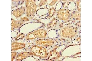 Immunohistochemistry of paraffin-embedded human kidney tissue using ABIN7145044 at dilution of 1:100 (ATAD3C antibody  (AA 1-122))