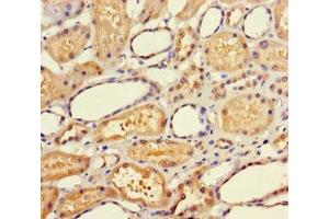 Immunohistochemistry of paraffin-embedded human kidney tissue using ABIN7145044 at dilution of 1:100 (ATAD3C antibody  (AA 1-122))