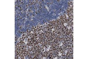 Immunohistochemical staining (Formalin-fixed paraffin-embedded sections) of human lymph node with MCM6 polyclonal antibody  shows strong nuclear positivity in reaction center cells.