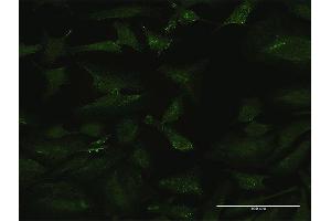 Immunofluorescence of purified MaxPab antibody to CSF3 on HeLa cell. (G-CSF antibody  (AA 1-207))