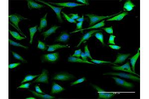 Immunofluorescence (IF) image for anti-Heterogeneous Nuclear Ribonucleoprotein D (HNRNPD) (AA 1-355) antibody (ABIN516589)