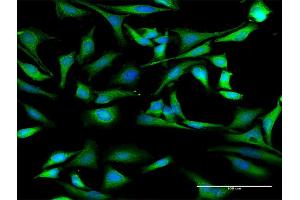 Immunofluorescence of purified MaxPab antibody to HNRNPD on HeLa cell. (HNRNPD/AUF1 antibody  (AA 1-355))