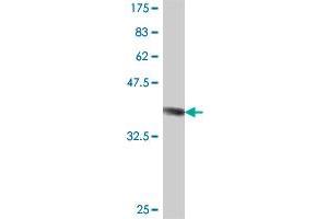 Western Blot detection against Immunogen (37. (B3GALT5 antibody  (AA 29-128))