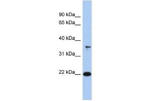 FAIM antibody used at 1 ug/ml to detect target protein. (FAIM antibody  (N-Term))