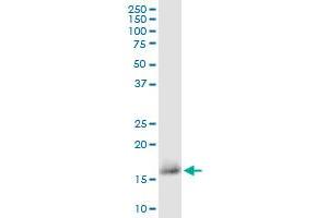 CD59 monoclonal antibody (M02), clone 3G6. (CD59 antibody  (AA 1-128))