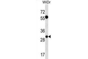 Western Blotting (WB) image for anti-Exosome Component 6 (EXOSC6) antibody (ABIN3000677)