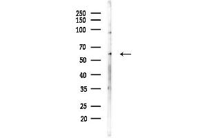 anti-Recombination Activating Gene 2 (RAG2) (N-Term) antibody