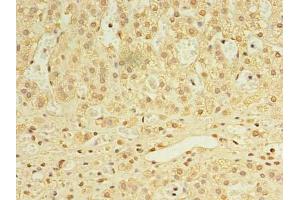Immunohistochemistry (IHC) image for anti-UTP23, Small Subunit (SSU) Processome Component, Homolog (UTP23) (AA 1-249) antibody (ABIN7168458)