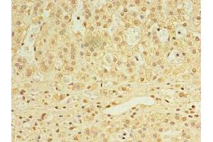 Immunohistochemistry of paraffin-embedded human adrenal gland tissue using ABIN7168458 at dilution of 1:100 (UTP23 antibody  (AA 1-249))
