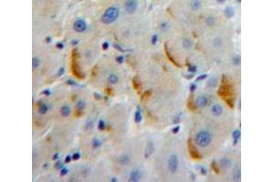 Used in DAB staining on fromalin fixed paraffin-embedded Liver tissue (LILRA2 antibody  (AA 217-438))