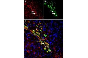 Expression of VMAT2 in rat substantia nigra dopaminergic neurons - Immunohistochemical staining of perfusion-fixed frozen rat brain sections using Anti-VMAT2 Antibody (ABIN7043688, ABIN7044610 and ABIN7044611), (1:1000). (SLC18A2 antibody  (1st Lumenal Region))
