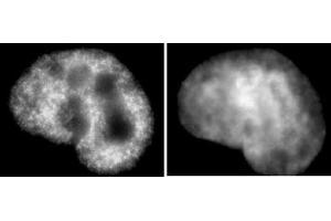 Histone H3K9ac antibody (mAb) (Clone 2G1F9) tested by immunofluorescence.