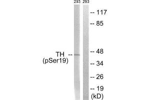 Western Blotting (WB) image for anti-Tyrosine Hydroxylase (TH) (pSer19) antibody (ABIN1847228) (Tyrosine Hydroxylase antibody  (pSer19))