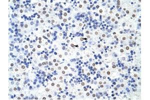 HNRPUL1 antibody was used for immunohistochemistry at a concentration of 4-8 ug/ml to stain Hepatocytes (arrows) in Human Liver. (HNRNPUL1 antibody  (C-Term))