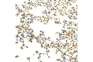 Immunohistochemistry analysis of paraffin-embedded mouse inflammation lung using Eif2ak1 (ABIN7073875) at dilution of 1: 1000 (EIF2AK1 antibody)