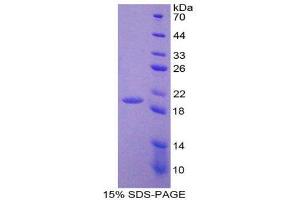 SDS-PAGE (SDS) image for Adrenomedullin (ADM) (AA 22-147) protein (His tag) (ABIN1078742)