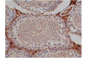 Immunohistochemistry (IHC) image for anti-Microtubule-Associated Protein tau (MAPT) (pSer422) antibody (ABIN6256330)