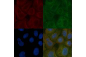 TMEM123 Mouse Monoclonal Antibody staining Hela cells by IF/ICC.
