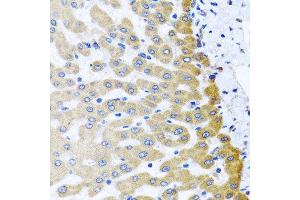 Immunohistochemistry of paraffin-embedded human liver injury using M6PR antibody at dilution of 1:100 (x40 lens).