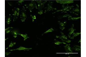 Immunofluorescence (IF) image for anti-Syntaxin 4 (STX4) (AA 19-119) antibody (ABIN520591)