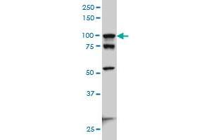 Western Blotting (WB) image for anti-Actinin, alpha 4 (ACTN4) (AA 592-701) antibody (ABIN559759)