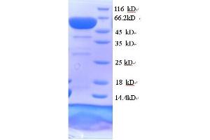 SDS-PAGE (SDS) image for Collapsin Response Mediator Protein 1 (CRMP1) (AA 1-572), (full length) protein (His tag) (ABIN5714348) (CRMP1 Protein (AA 1-572, full length) (His tag))