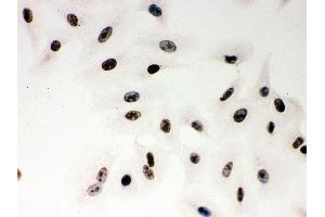 Immunohistochemistry (IHC) image for anti-Poly (ADP-Ribose) Polymerase 1 (PARP1) (AA 670-858) antibody (ABIN3043378)