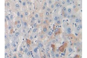 Detection of TARC in Mouse Liver Tissue using Polyclonal Antibody to Thymus Activation Regulated Chemokine (TARC) (CCL17 antibody  (AA 12-83))