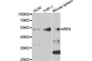 Western blot analysis of extracts of various cell lines, using IRF8 antibody. (IRF8 antibody)