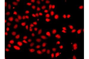 Immunofluorescence analysis of  cells using EP/HIF2α antibody (ABIN6127869, ABIN6141764, ABIN6141765 and ABIN6223457). (EPAS1 antibody  (AA 588-870))