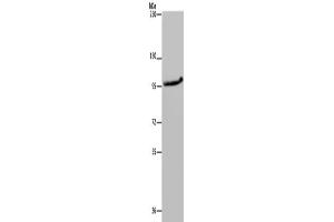 Western Blotting (WB) image for anti-Mitogen-Activated Protein Kinase Kinase Kinase 11 (MAP3K11) antibody (ABIN2433391)