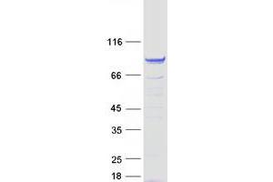 Validation with Western Blot