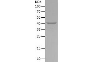 Western Blotting (WB) image for Melanoma Antigen Family A, 3 (MAGEA3) (AA 1-145) protein (His-IF2DI Tag) (ABIN7123886) (MAGEA3 Protein (AA 1-145) (His-IF2DI Tag))