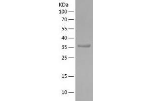 Western Blotting (WB) image for Microtubule-Associated Protein 1 Light Chain 3 beta (MAP1LC3B) (AA 1-107) protein (His-IF2DI Tag) (ABIN7123959) (LC3B Protein (AA 1-107) (His-IF2DI Tag))