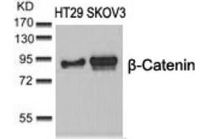Image no. 3 for anti-Catenin (Cadherin-Associated Protein), beta 1, 88kDa (CTNNB1) (Ser37) antibody (ABIN197447) (CTNNB1 antibody  (Ser37))
