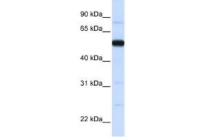 THUMPD2 antibody used at 1 ug/ml to detect target protein. (THUMPD2 antibody  (N-Term))