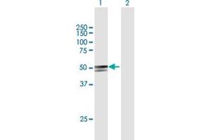 Western Blot analysis of ANKDD1A expression in transfected 293T cell line by ANKDD1A MaxPab polyclonal antibody. (ANKDD1A antibody  (AA 1-423))