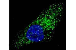 Fluorescent image of  cells stained with ATG9A (C-term) antibody.
