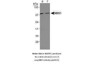 Image no. 2 for anti-NLR Family, Pyrin Domain Containing 2 (NLRP2) (AA 150-200) antibody (ABIN363677) (NLRP2 antibody  (AA 150-200))