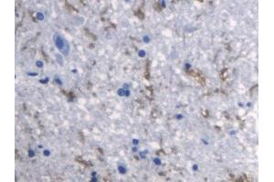 DAB staining on IHC-P; Samples: Rat Spinal cord Tissue (RANKL antibody  (AA 106-240))