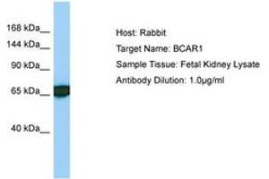 Image no. 1 for anti-Breast Cancer Anti-Estrogen Resistance 1 (BCAR1) (AA 456-505) antibody (ABIN6749973) (BCAR1 antibody  (AA 456-505))